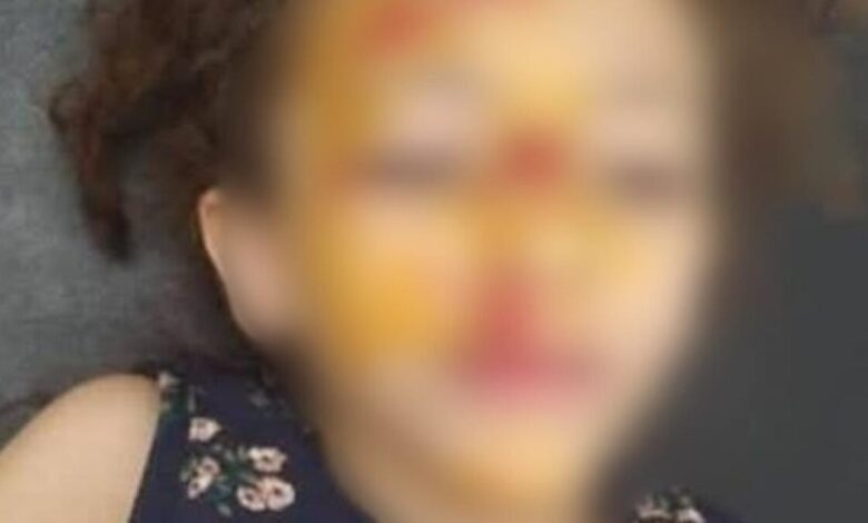 لحظة مأساوية في سوهاج.. كاميرات المراقبة توثق إصابة طفلة بدراجة نارية