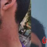 شاب يستغيث بعد واقعة اعتداء عليه داخل مصنع أثاث شهير بدمياط «أنا مش بطلب انتقام.. أنا بطلب حقي»