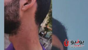 شاب يستغيث بعد واقعة اعتداء عليه داخل مصنع أثاث شهير بدمياط «أنا مش بطلب انتقام.. أنا بطلب حقي»