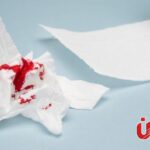 نزول دم بعد انتهاء الدورة.. الأسباب المحتملة ومتى تراجعين الطبيب؟